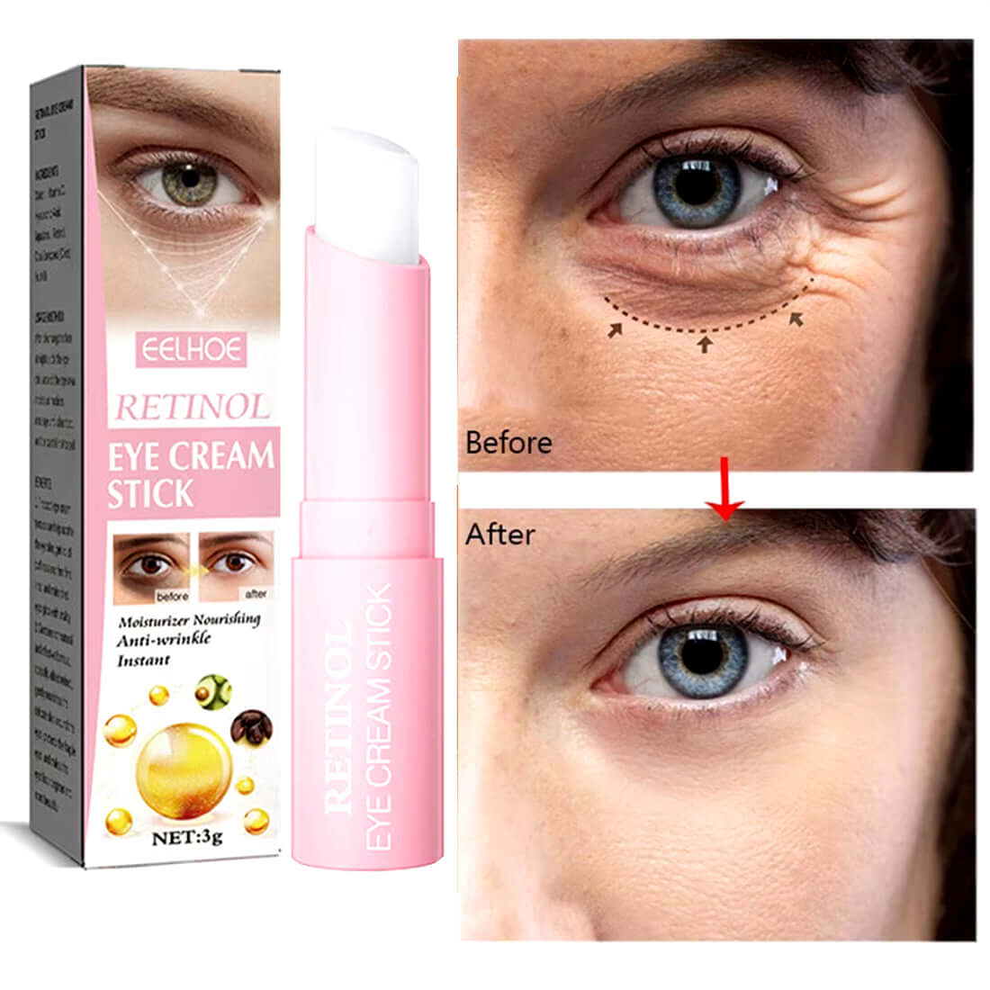 Retinol Eye Cream Instant Removing Eyes Wrinkle Eyes Dark Circles Bags Remover Moisturizing Stick Beauty Health Korea Cosmetics