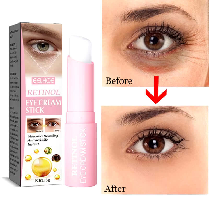 Retinol Eye Cream Instant Removing Eyes Wrinkle Eyes Dark Circles Bags Remover Moisturizing Stick Beauty Health Korea Cosmetics