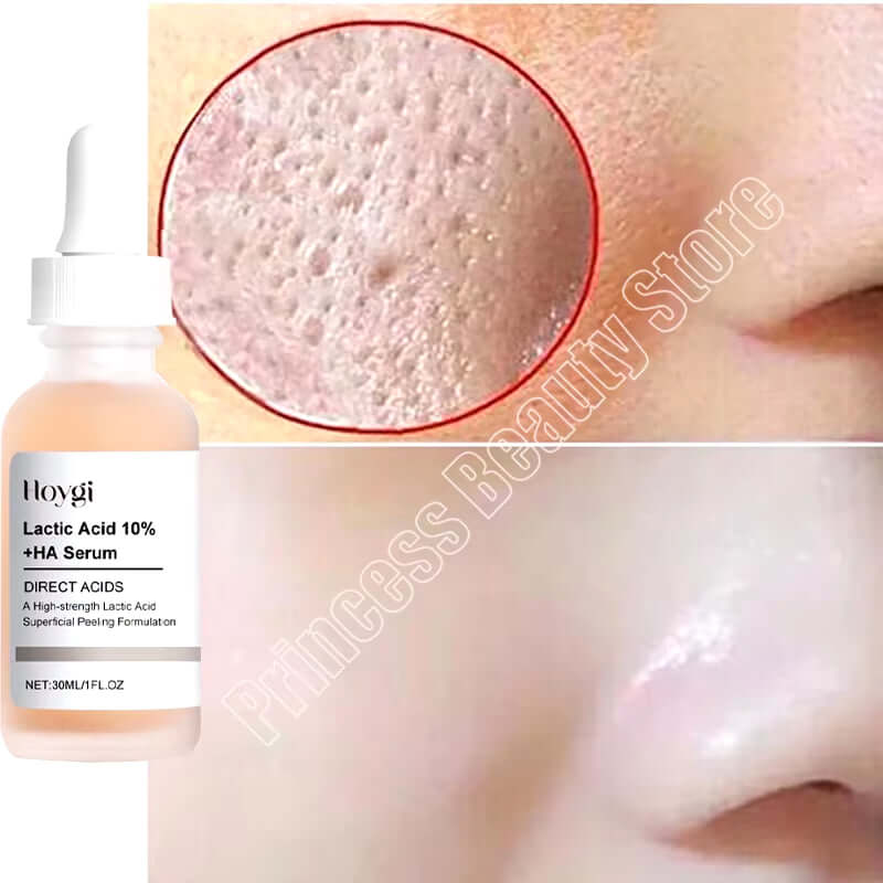 Remove Large Pores Serum Lactic Acid Facial Pore Shrinking Repairing Products Pore Minimizing Firming Smooth Korean Skin Care