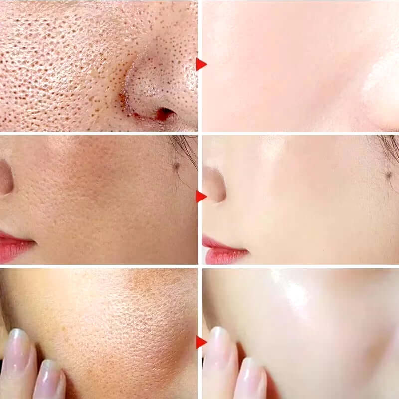 Remove Large Pores Serum Lactic Acid Facial Pore Shrinking Repairing Products Pore Minimizing Firming Smooth Korean Skin Care