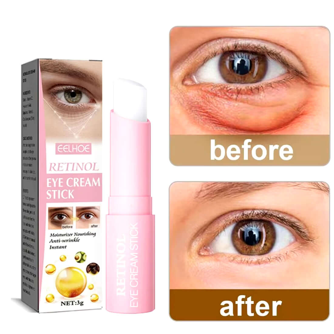 Retinol Eye Cream Instant Removing Eyes Wrinkle Eyes Dark Circles Bags Remover Moisturizing Stick Beauty Health Korea Cosmetics