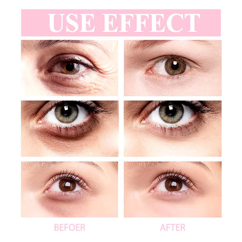 Retinol Eye Cream Instant Removing Eyes Wrinkle Eyes Dark Circles Bags Remover Moisturizing Stick Beauty Health Korea Cosmetics